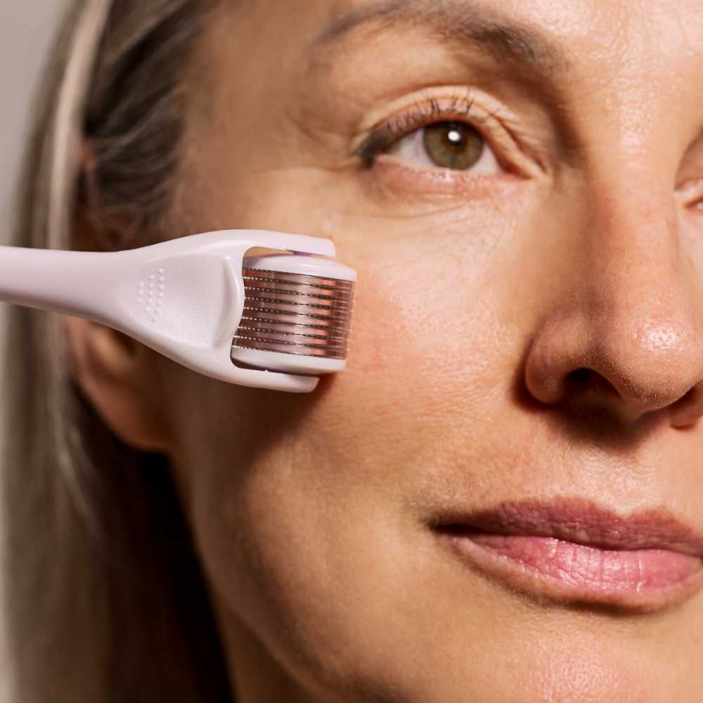 Derma Roller System 1mm Skin Therapy Micro 540 Needles